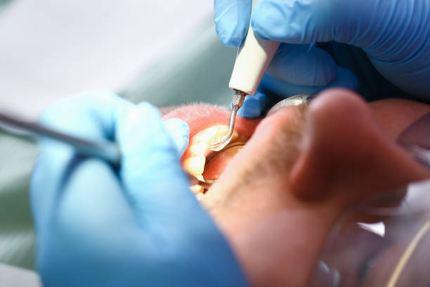 Best Knocked-Out Tooth Emergency  in Manchester, WA