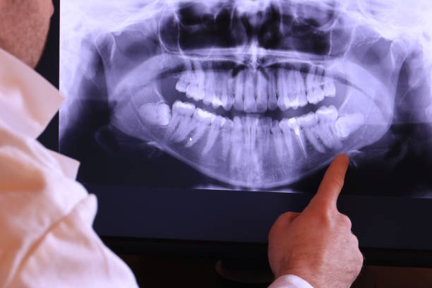 Best Teeth Whitening  in Manchester, WA